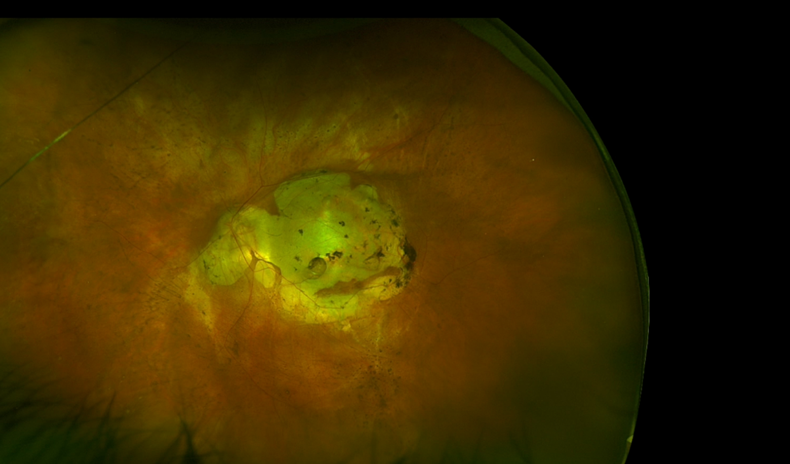Case of the Month